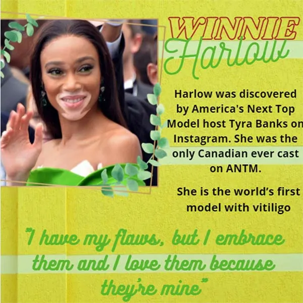 Winnie Harlow, YMCA Plusone Mentoring Black History Spotlight